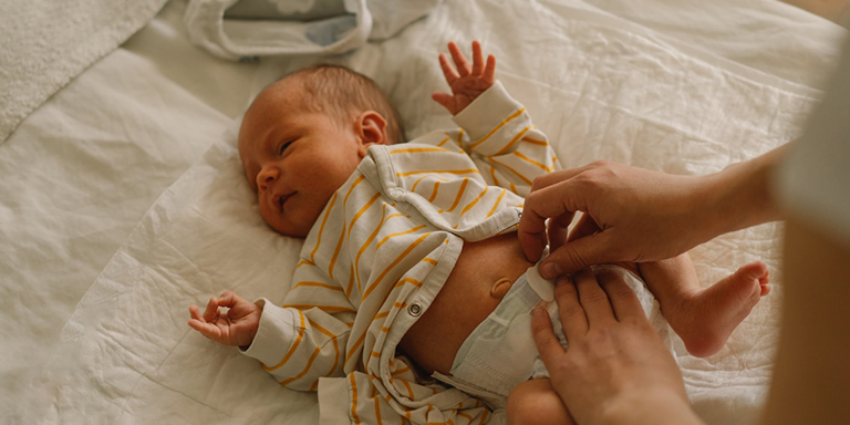 Stitichezza nel neonato